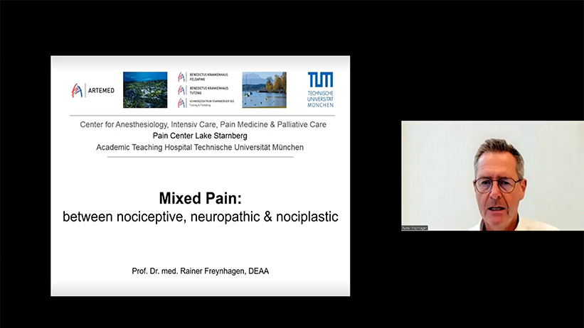 Video 2023 on Mixed pain between Nociceptive Neuropathic and Nociplastic Pain